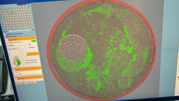 ҵһߣɸѡһϸõƣһѻ֢ԭҩβ