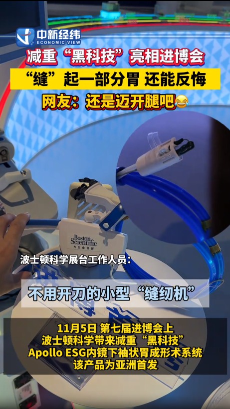 减重“黑科技”亮相进博会 “缝”起一部分胃 还能反悔